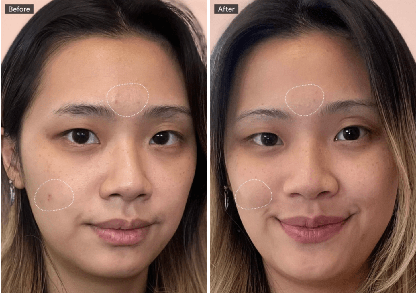 Before and After